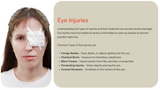 First Aid Fundamentals